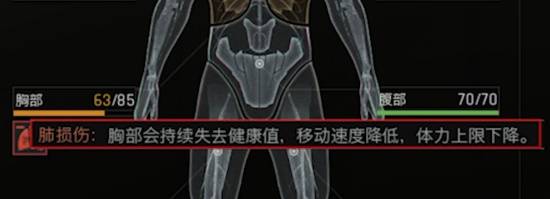 《暗区突围无限》健康系统机制解读